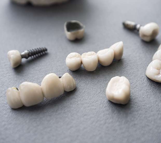 Oak Ridge The Difference Between Dental Implants and Mini Dental Implants